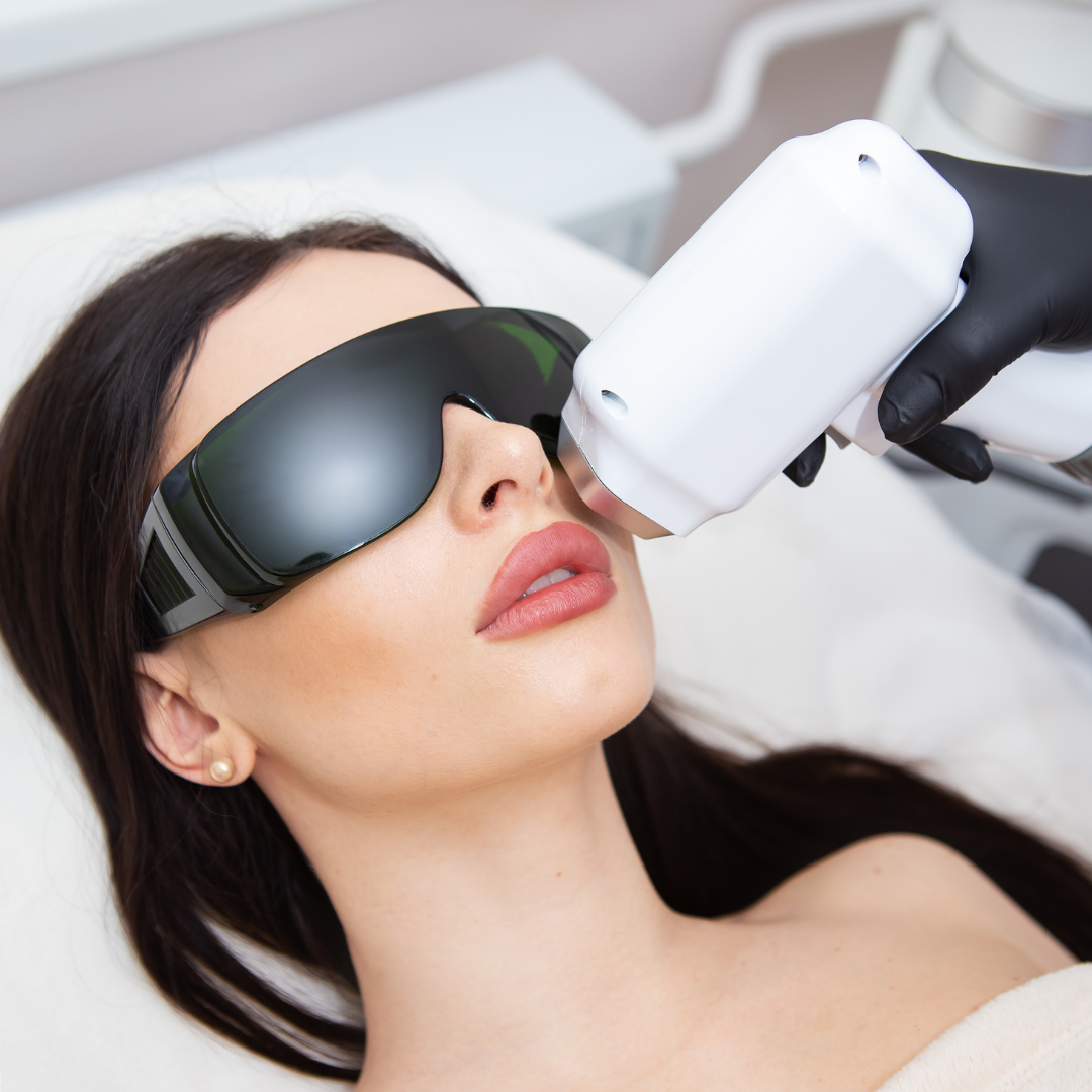 Mulher com pele lisa após depilação a laser YESlaser